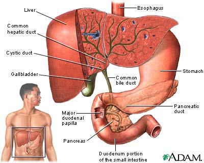 Gall Stones! Why Carry The Weight?