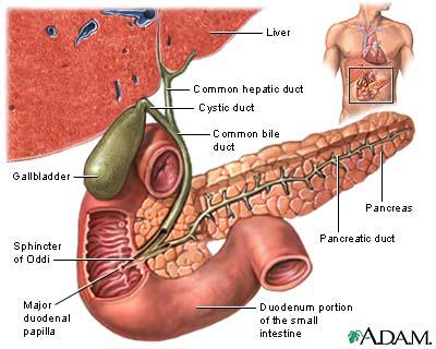 Gall Stones! Why Carry The Weight?