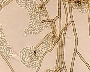 Phialophora_verrucosa_microscopy-8x6.jpg