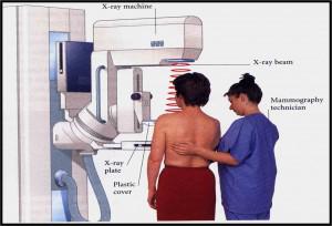 mammograms for women at 40