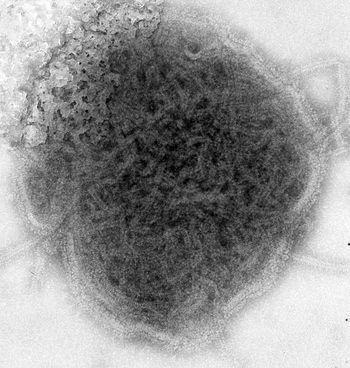 Mumps virus, negative stained TEM 8758 lores