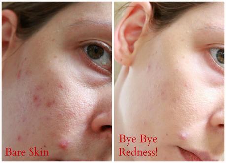 IT Cosmetics Bye Bye Redness - Saving Face One Red Blotch At A Time
