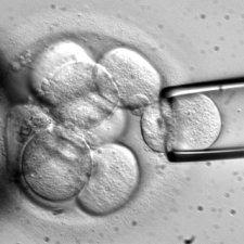 Collection of stem cells from a fertilized embryo.  This is done with very tiny instruments under high magnification.
