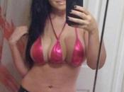 Total Recall Real-Life: Meet Woman with Three Breasts