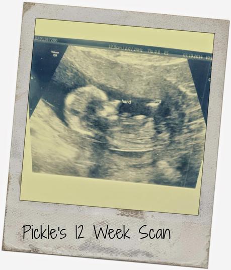 Pickle's 12 Week Scan