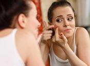 Things Acne Reveal About Your Health