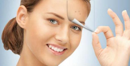 dry-skin-acne-home-remedies-1