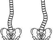 Friday Q&amp;A: Practice Side Plank Pose (Vashithasana) Scoliosis