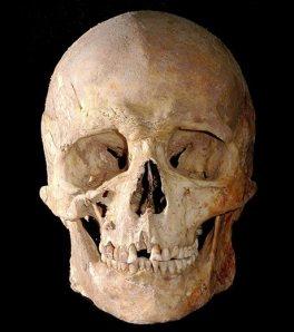 Mesolithic Skull