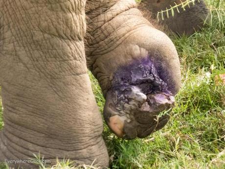 This elephant's foot was damaged by a landmine. Now covered in purple antibiotics and healing under the care of The Elephant Nature Park