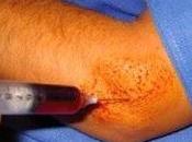 Patient "Heal Thyself" Using Your Blood