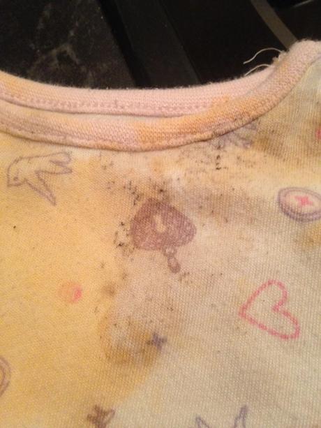 My worst stain