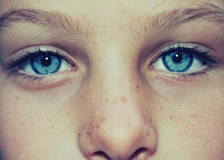 Remove Freckles Easy ways