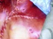 Concern About Torture Misplaced Says Christian Writer