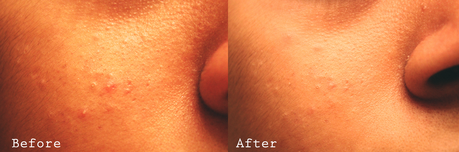 Leaders AC Clear | Before and After Leaders AC Clear | Before and After