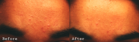 Leaders AC Clear | Before and After Leaders AC Clear | Before and After