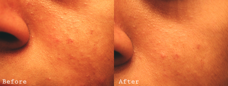 Leaders AC Clear | Before and After Leaders AC Clear | Before and After