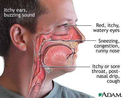 Common Nasal Problems In Hilly Nepal