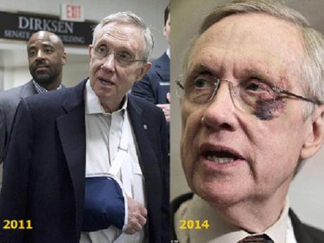 Reid's injuries 2011 & 2014