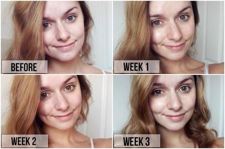 Skincare | Trialling Face B4