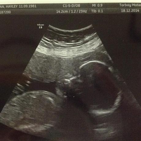 Bump Watch: 26 Weeks