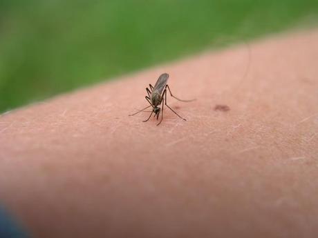 10 Remedies for mosquito bites