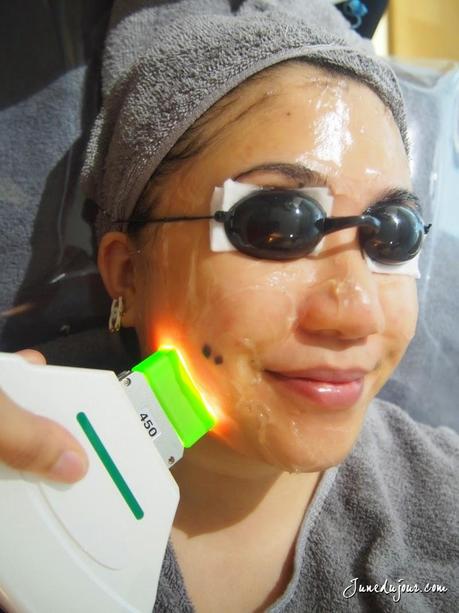 Review: Hadara Aesthetics Lazer Glow & Power Facial