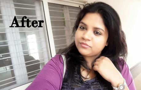 How I got Rid of Pimples | My Current Skincare Routine