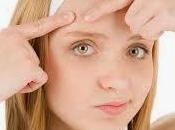 Amazing Tips Tricks Acne Treatment Care