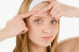 Amazing tips and tricks for acne treatment and care