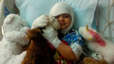 Jayden suffered third-degree burns to her head and first and second-degree burns to her hands. (Credit: WIBW)