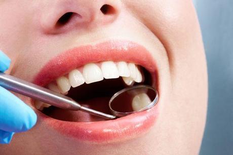 Home Remedies for Tooth Cavity