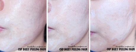 CNP Laboratory daily peeling foam (5)