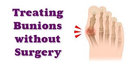 Bunion Treatment Without Surgery - It May be Easier Than You Think