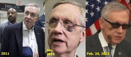 Harry Reid injuries