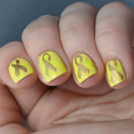 Twinsie Tuesday: Endometriosis Awareness Twinsie Tuesday: Endometriosis Awareness