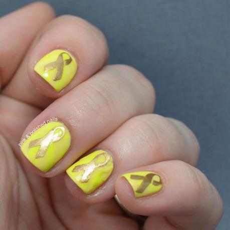 Twinsie Tuesday: Endometriosis Awareness Twinsie Tuesday: Endometriosis Awareness