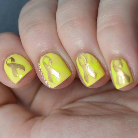 Twinsie Tuesday: Endometriosis Awareness Twinsie Tuesday: Endometriosis Awareness