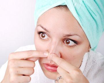 Best Remedies for Nose Acne