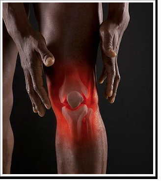 Pes Anserine Bursitis - knee pain