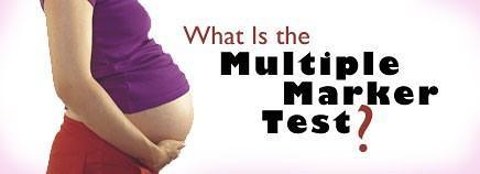 Multiple marker pregnancy test - How they can help detect chromosomal abnormalities