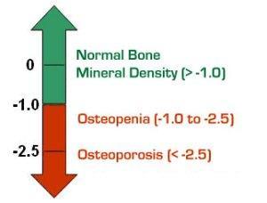 Osteoporosis and Osteopinia graph
