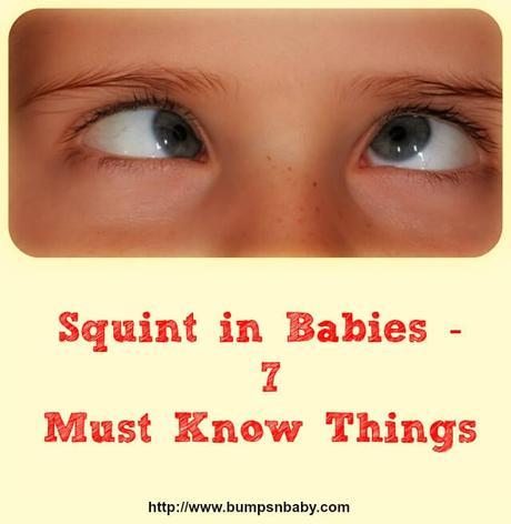 Squint in Babies – 7 Things You Need To Know