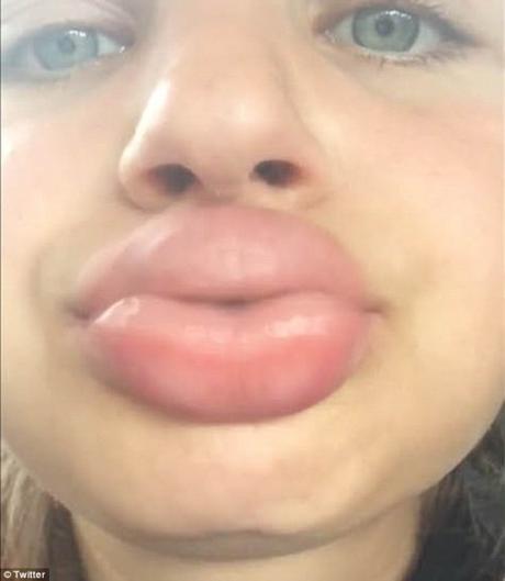 ‘Kylie Jenner Challenge': The Latest in Idiotic Teen Crazes