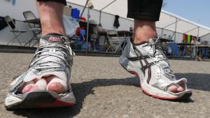 feet utpal 300x169 Self Transcendence 10 Day Race 2015 – 48 Hour Updates