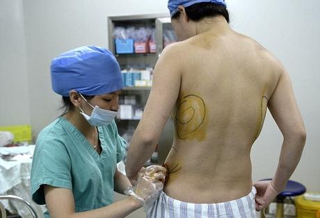 Dangerous: Women in China were given a highly toxic implants, called polyacrylamide hydrophilic gel, for breast augmentation until the material was banned by the government in 2006