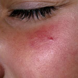 Press Release 6 Pregnancy Beauty Problems And How To Fix Them