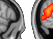 Observing Brain Correlates Social Interactions.