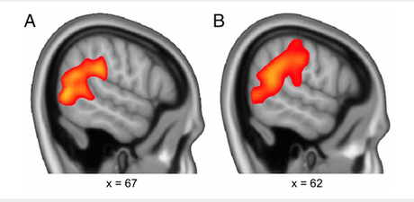 Observing brain correlates of social interactions.