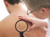 Facts Everyone Need Know About Skin Cancer